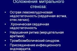 Осложнения митрального стеноза