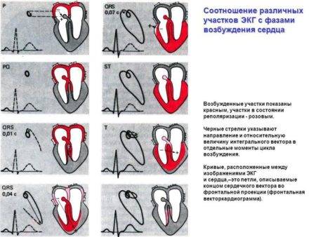 Экг нарушение процессов реполяризации