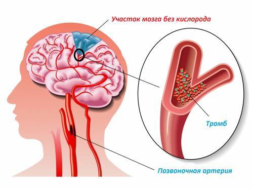 участки мозга