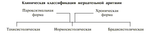 виды нарушений ритма