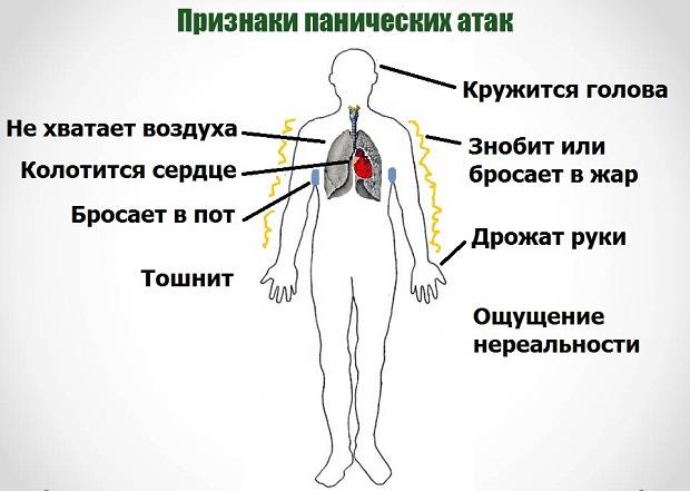 Панические атаки