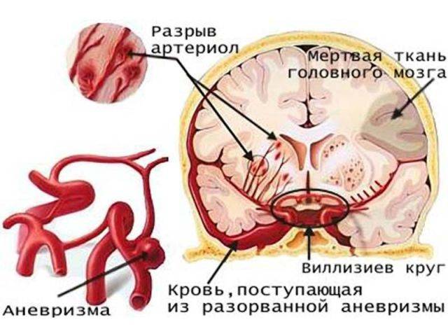 Анатомия артерий мозга