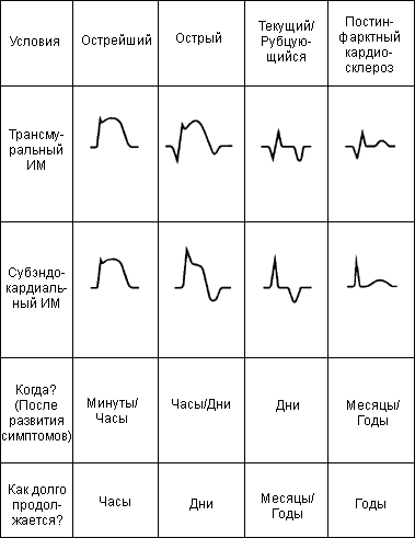 инфаркт миокарда q