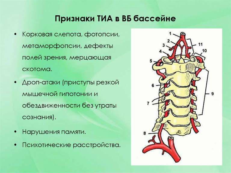 Что такое транзиторная ишемическая атака