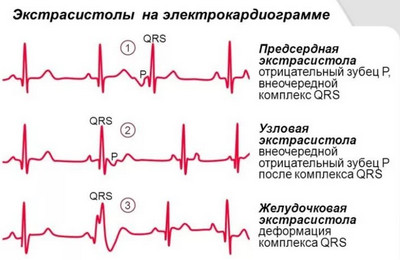 причины возникновения