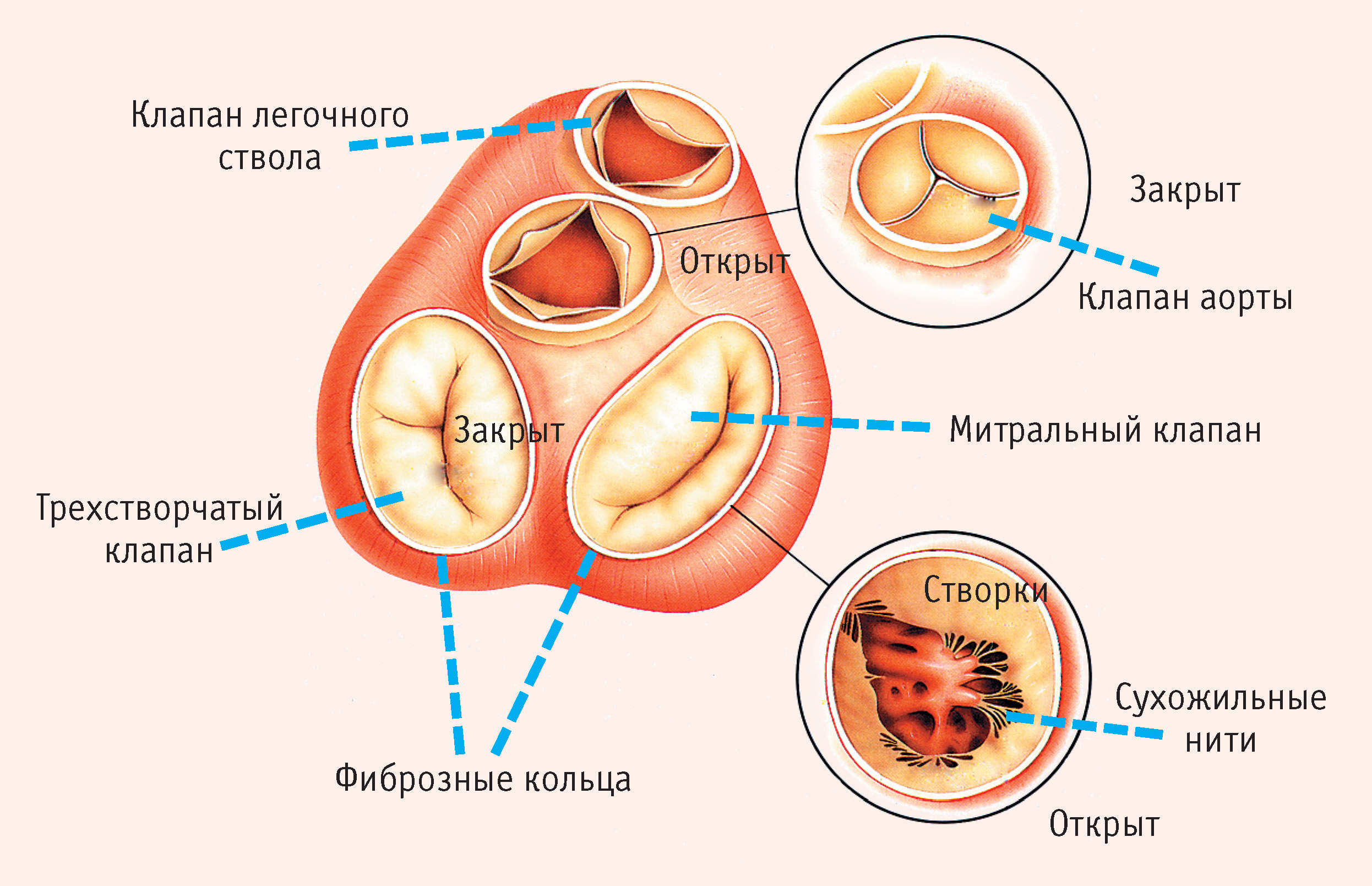 Порок сердца Порок сердца