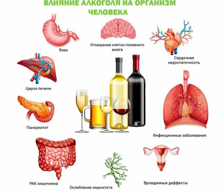 Вывод из запоя на дому
